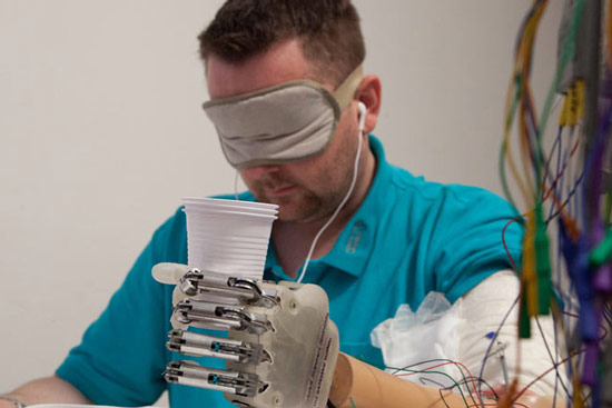 Student mit elektronischer Handprothese
